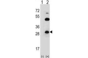 Western Blotting (WB) image for anti-Claudin 2 (CLDN2) antibody (ABIN2996861) (Claudin 2 antibody)