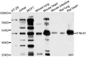Western blot analysis of extracts of various cell lines, using IFNLR1 antibody (ABIN4904012) at 1:1000 dilution. (IL28RA antibody)