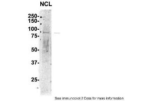 Sample Type: 1. (Nucleolin antibody  (C-Term))