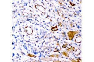 IHC analysis of Plectin using anti-Plectin antibody (ABIN3043900). (PLEC antibody  (Middle Region))
