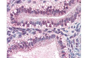 Anti-CRABP2 antibody IHC of human uterus. (CRABP2 antibody  (AA 1-138))