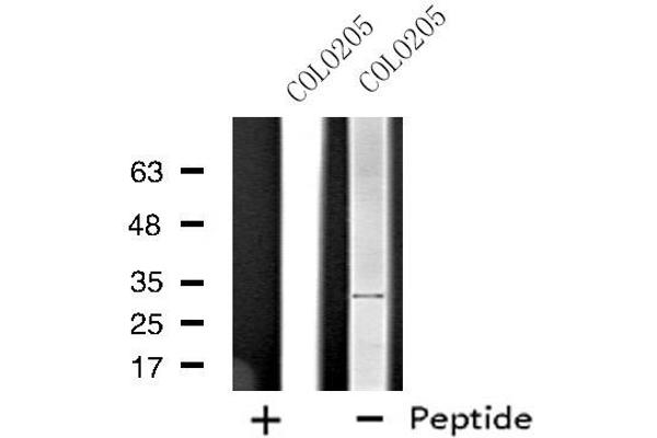 STARD10 antibody  (Internal Region)