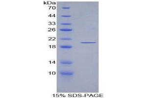 SDS-PAGE (SDS) image for Ecotin (AA 21-162) protein (His tag) (ABIN1079430) (Ecotin (AA 21-162) protein (His tag))