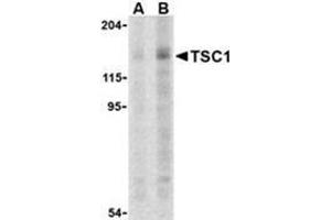 Western blot analysis of TSC1 in C2C12 cell lysate with this product at (A) 2 and (B) 4 μg. (TSC1 antibody  (C-Term))