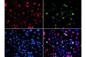 Immunofluorescence (IF) image for anti-Tumor Protein P53 (TP53) (pSer15) antibody (ABIN3023601) (p53 antibody  (pSer15))