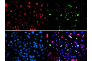 Immunofluorescence (IF) image for anti-Tumor Protein P53 (TP53) (pSer15) antibody (ABIN3023601) (p53 antibody  (pSer15))