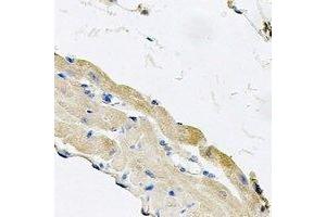 Immunohistochemical analysis of Cytochrome P450 2F1 staining in mouse lung formalin fixed paraffin embedded tissue section. (CYP2F1 antibody)