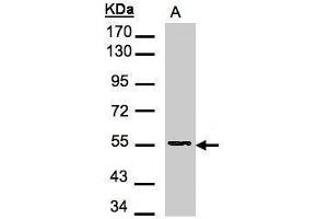 WB Image Sample(30 μg of whole cell lysate) A:H1299 7. (Aspartyl Aminopeptidase antibody)