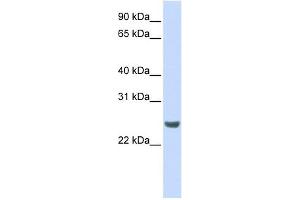 NKIRAS1 antibody used at 1 ug/ml to detect target protein. (NKIRAS1 antibody  (N-Term))