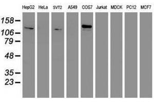 Image no. 8 for anti-Glutamyl Aminopeptidase (Aminopeptidase A) (ENPEP) antibody (ABIN1498029) (ENPEP antibody)