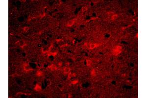 Formalin-fixed and paraffin-embedded rat brain labeled with Anti-ITM2A Polyclonal Antibody, Unconjugatedused at 1:200 dilution for 40 minutes at 37°C.