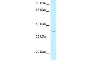 Western Blot showing Six1 antibody used at a concentration of 1.