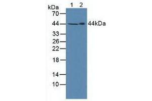 Figure. (SPHK1 antibody  (AA 148-398))