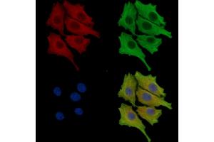 ABIN7095746 and ABIN7099808 staining HepG2 cells by IF/ICC. (TFB1M antibody)