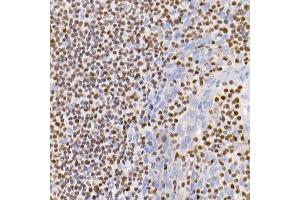 Immunohistochemistry of paraffin-embedded human tonsil using IKZF3 antibody (ABIN7267842) at dilution of 1:100 (40x lens). (IKZF3 antibody)
