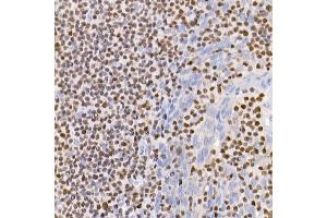 Immunohistochemistry of paraffin-embedded human tonsil using IKZF3 antibody (ABIN7267842) at dilution of 1:100 (40x lens).