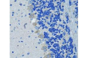 Immunohistochemistry of paraffin-embedded Mouse brain using Nestin Polyclonal Antibody at dilution of 1:100 (40x lens). (Nestin antibody)