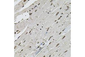 Immunohistochemistry of paraffin-embedded mouse heart using CTNNB1 antibody (ABIN4903403) at dilution of 1:100 (40x lens). (CTNNB1 antibody)