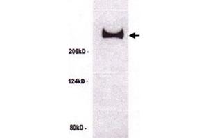 Western blot analysis of TP53BP1 in untreated U-2 OS cell lysate with TP53BP1 polyclonal antibody .