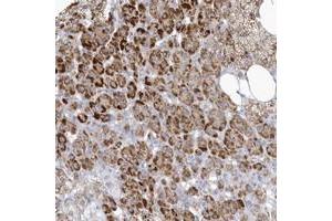 Immunohistochemical staining of human adrenal gland with NPAL1 polyclonal antibody  shows strong cytoplasmic positivity in cortical cells at 1:20-1:50 dilution. (NIPAL1 antibody)