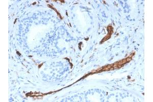 Immunohistochemistry (IHC) image for anti-Platelet/endothelial Cell Adhesion Molecule (PECAM1) (AA 625-738) antibody (ABIN6940278)