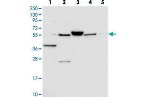 Western blot analysis of Lane 1: RT-4, Lane 2: U-251 MG, Lane 3: Human Plasma, Lane 4: Liver, Lane 5: Tonsil with C10orf129 polyclonal antibody . (C10ORF129 antibody)