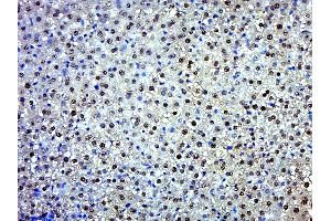 Paraformaldehyde-fixed, paraffin embedded Rat liver Antigen retrieval by boiling in sodium citrate buffer (pH6. (EXD2 antibody  (AA 351-621))