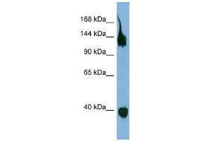 SEMA6A antibody used at 1 ug/ml to detect target protein. (SEMA6A antibody  (Middle Region))