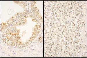 anti-F-Box Protein 38 (FBXO38) (AA 825-875) antibody