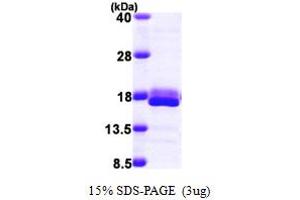 SDS-PAGE (SDS) image for Eukaryotic Translation Initiation Factor 4E Binding Protein 2 (EIF4EBP2) (AA 1-120) protein (His tag) (ABIN667385) (eIF4EBP2 Protein (AA 1-120) (His tag))