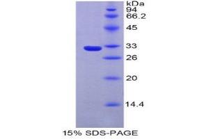 SDS-PAGE (SDS) image for Iduronate 2-Sulfatase (IDS) (AA 180-448) protein (His tag) (ABIN1877883) (IDS Protein (AA 180-448) (His tag))