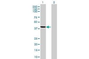 Lane 1: RBMY1A1 transfected lysate ( 40.