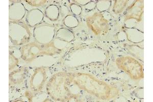 Immunohistochemistry of paraffin-embedded human kidney tissue using ABIN7174641 at dilution of 1:100 (UGT2B4 antibody  (AA 281-481))