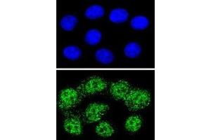 Confocal immunofluorescent analysis of MSH2 antibody with HeLa cells followed by Alexa Fluor 488-conjugated goat anti-rabbit lgG (green). (MSH2 antibody  (AA 637-665))
