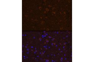 Immunofluorescence analysis of mouse spinal cord using CNTF Rabbit pAb (ABIN3015704, ABIN3015705, ABIN3015706 and ABIN6219054) at dilution of 1:100 (40x lens). (CNTF antibody  (AA 1-200))