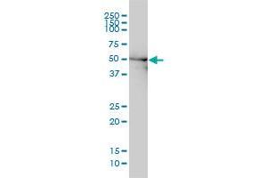 DDX6 monoclonal antibody (M01), clone 3D2 Western Blot analysis of DDX6 expression in Hela . (DDX6 antibody  (AA 1-483))