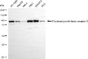 Western blotting analysis using fibroblast growth factor receptor 3 antibody (ABIN7798610). (Recombinant FGFR3 antibody)