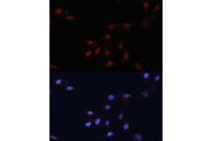 Immunofluorescence analysis of NIH/3T3 cells using p53 antibody (ABIN3017540, ABIN3017541, ABIN3017542 and ABIN6220145) at dilution of 1:100. (p53 antibody)
