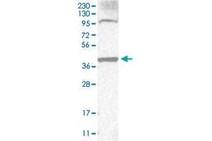 Western Blot (Cell lysate) analysis of RT-4 cell lysate with CD34 polyclonal antibody . (CD34 antibody)