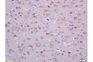 Formalin-fixed and paraffin embedded rat brain labeled with Rabbit Anti ACTH (18-39) Polyclonal Antibody, Unconjugated (ABIN668661) at 1:200 followed by conjugation to the secondary antibody and DAB staining