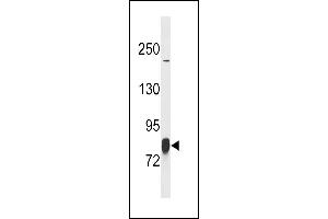 LIMK1 Antibody (T9) (ABIN392258 and ABIN2841942) western blot analysis in SK-BR-3 cell line lysates (35 μg/lane). (LIM Domain Kinase 1 antibody  (N-Term))