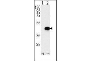 Western blot analysis of BCKDK (arrow) using rabbit polyclonal BCKDK Antibody (BCKDK antibody  (Middle Region))