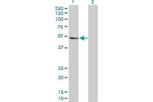 Western Blot analysis of PAX6 expression in transfected 293T cell line by PAX6 MaxPab polyclonal antibody. (PAX6 antibody  (AA 1-422))
