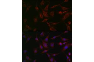 Immunofluorescence analysis of BALB-3T3 cells using NSF Rabbit pAb (ABIN6130571, ABIN6144871, ABIN6144872 and ABIN6214029) at dilution of 1:100 (40x lens). (NSF antibody  (AA 1-250))