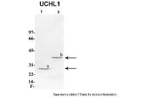Sample Type: 1. (UCHL1 antibody  (C-Term))