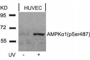 Image no. 4 for anti-Protein Kinase, AMP-Activated, alpha 1 Catalytic Subunit (PRKAA1) (pSer487) antibody (ABIN196905) (PRKAA1 antibody  (pSer487))