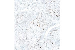 Immunohistochemistry (IHC) image for anti-Cyclin-Dependent Kinase Inhibitor 1A (p21, Cip1) (CDKN1A) (AA 100-150) antibody (ABIN7795765)