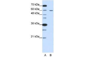 Western Blot showing FZD5 antibody used at a concentration of 1-2 ug/ml to detect its target protein. (FZD5 antibody)