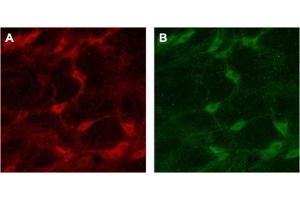 Expression of p75NTR in rat brain - Immunohistochemical staining of rat brain with Anti-p75 NGF Receptor (extracellular) Antibody (ABIN7043344, ABIN7044755 and ABIN7044756). (NGFR antibody  (Extracellular))