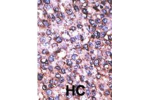 Immunohistochemistry (IHC) image for anti-Melanoma Antigen Family D, 2 (MAGED2) antibody (ABIN3002534) (MAGED2 antibody)